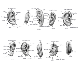 Click image for larger version

Name:	ears.png
Views:	95
Size:	374.2 KB
ID:	3410