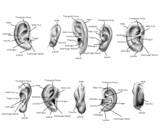 Click image for larger version

Name:	ears.png
Views:	66
Size:	374.2 KB
ID:	3410