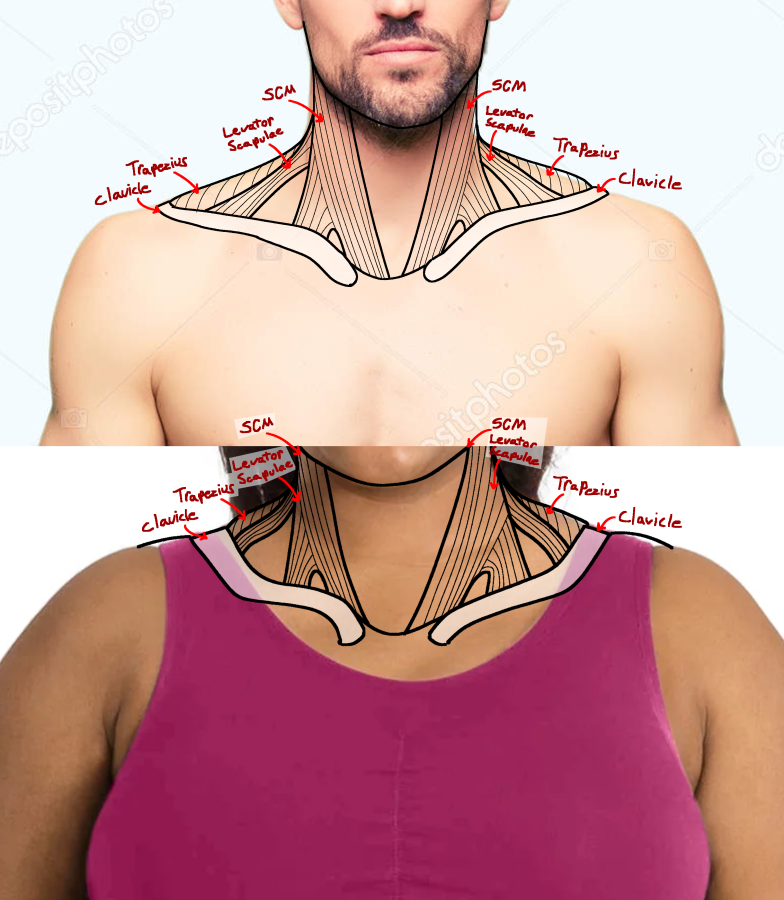 Click image for larger version

Name:	LG_ShoulderTracesAnt.png
Views:	114
Size:	536.6 KB
ID:	9708